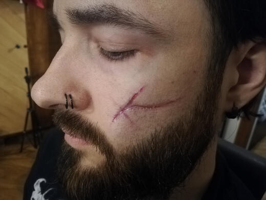 SFX application Scar test on myself by VampyCrafts in Riga.